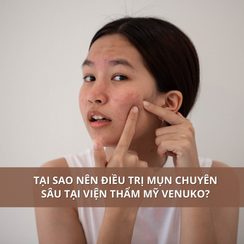 Tại sao nên điều trị mụn chuyên sâu tại viện thẩm mỹ Venuko?