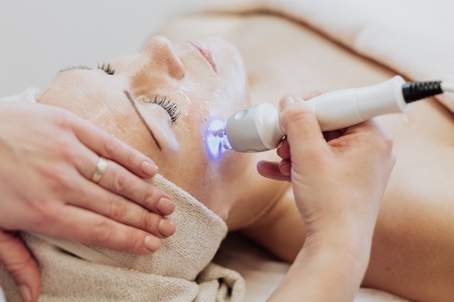 6 Cách trị đồi mồi hiệu quả được nhiều người áp dụng nhất