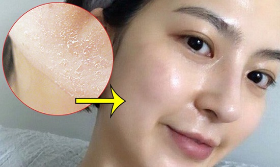Top 5 Serum phục hồi da sau peel tốt nhất hiện nay 2022
