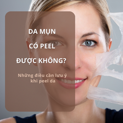 Da mụn có peel được không? Có an toàn và hiệu quả? Những điều cần lưu ý