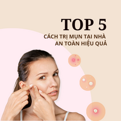 Top 5 cách trị mụn tại nhà an toàn, hiệu quả bạn không nên bỏ lỡ
